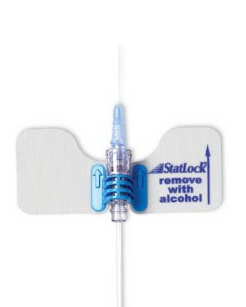 Statlock - Extension Set with Stabilization Device StatLock 6 Inch Tubing 1 Port DEHP-Free - IV0540