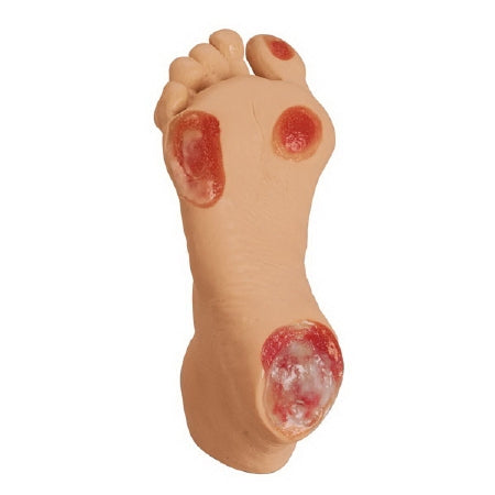 Nasco Life/Form Pressure Ulcer Foot Model Adult - Geriatric 2-1/5 lbs. - LF00933