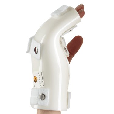 Corflex - Boxer Fracture Splint Palmar Pad Polyethylene / Foam Left Hand White Large - 37-1213-000