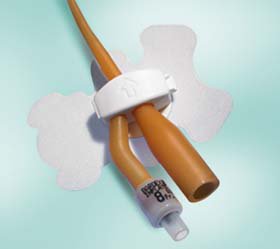 Statlock - Catheter / Line Securement Device - VFDSSP