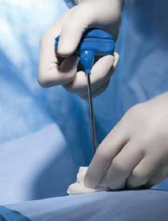 Safe-T Plus - Biopsy Tray Bone Marrow T-handle Jamshidi Needle / Marrow Acquisition Cradle - BCTM3411SP