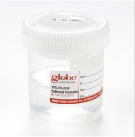 Tite-Rite - Prefilled Formalin Container 41 X 48 mm 45 mL in 90 mL (3 oz.) Screw Cap Warning Label / Patient Information NonSterile - Globe Scientific - 6525FL