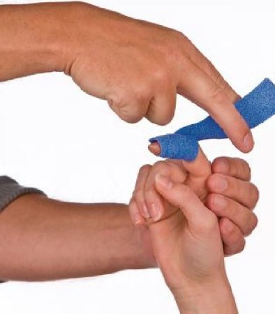 Orficast - Splinting Material 1-9/50 Inch X 9-4/5 Foot Thermoplastic Blue - 081616002