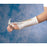 Patterson Medical Supply - Digital Extension Kit Right Hand - 7691