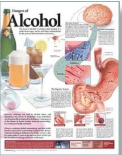 Anatomical Chart Company - Anatomical Chart Dangers of Alcohol 20 X 26 Inch Heavy Paper Grommets Laminated - 9780781782395