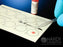 Hardy Diagnostics TRUST Rapid Test Kit RPR Card Test Syphilis Screen Serum / Plasma Sample Non-CLIA Waived 150 Tests - TRU150