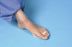 Dr. Jill's - Hammer Toe Splint One Size Fits Most Pull-On Left or Right Foot - BUDIN SPLINT DBLTOE