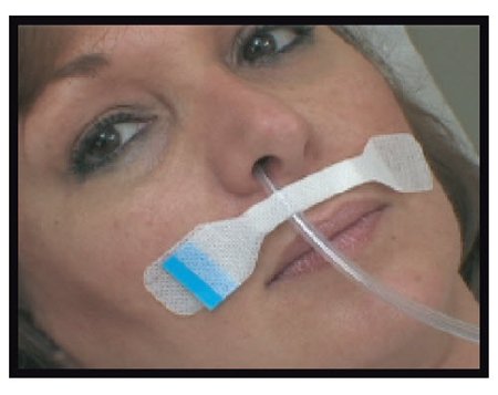 M.C. Johnson NG Secure Nasal Tube Holder 1 X 5 Inch Base, 1.875 X .375 Inch Holder - 9304-01