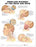 Anatomical Chart Company Anatomical Chart Co Anatomical Chart Whiplash Injuries of the Head and Neck - 9781587793769