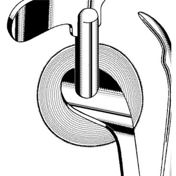 Sklar Instruments Blade Ring Cutter Chrome Ea - 822314
