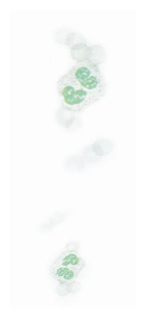 Quick III - Differential Rapid Stain Set 3 X 16 oz. - 22246493