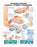 Anatomical Chart Company Anatomical Chart Carpal Tunnel Syndrome 20 X 26 Inch Heavy Paper Grommets Laminated - 9781587793226