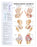 Anatomical Chart Company Anatomical Chart Arthritis 20 X 26 Inch Heavy Paper Grommets Laminated - 9781587793851
