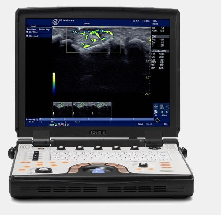 Ge Healthcare Ultrasound System Logiq E With Software, Cwd, 1024 X 768 Resolution Display, Tilt/Rotate Adjustable Monitor, Cp Back-Lighting, 1(+2) Probe Ports - H48142LD
