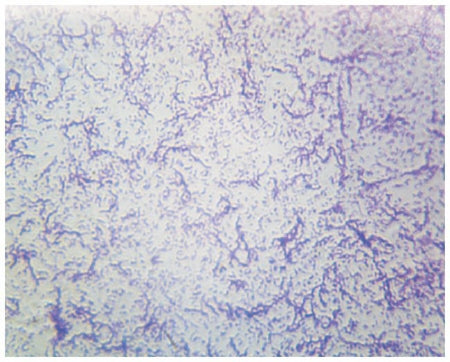 Fisher Scientific SLIDE, BACTERIA SMEAR TYPICAL - S06346PS