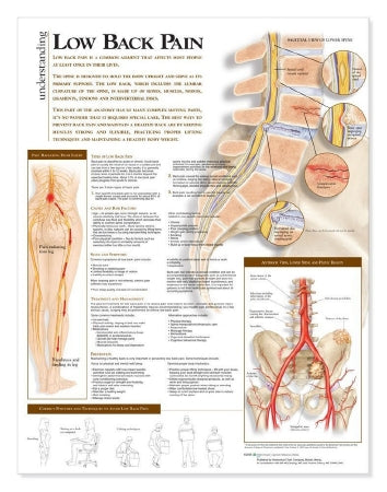 Anatomical Chart Company - Anatomical Chart Low Back Pain 20 X 26 Inch Heavy Paper Grommets Laminated - 9780781782425