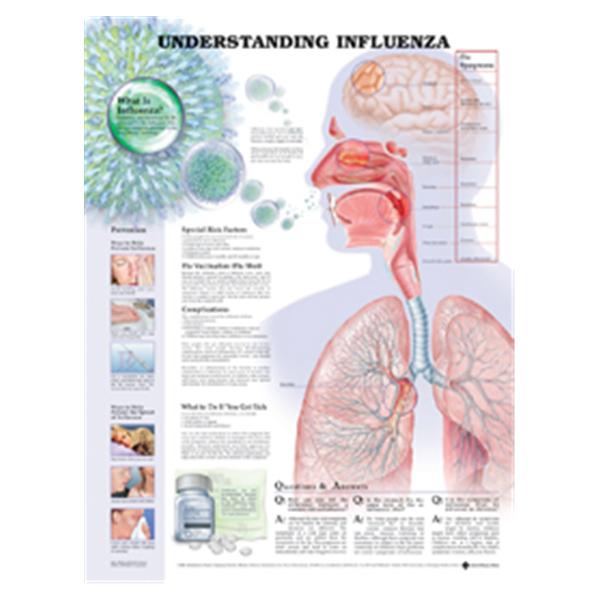 Wolters Kluwer Health Inc Chart Educational Understanding Influenza 20X26" Ea - 9781587798863