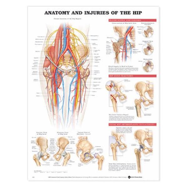 Wolters Kluwer Health Inc Chart Anatomical Anatomy And Injuries Of The Hip 20X26" Ea - 9781587793837