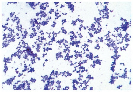 Fisher Scientific SLIDE BACTERIA BASIC 25/EA JOHANNES LIEDER - S68789