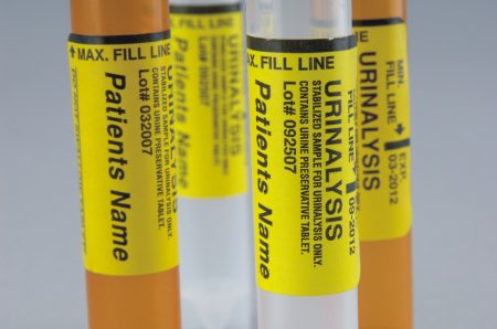 Thermo Scientific Capitol Vial - Urinalysis Tube Conical Bottom, Skirted Urine Preservative Tablet Additive 12 mL Yellow Screw Cap Polypropylene Tube - 14377860