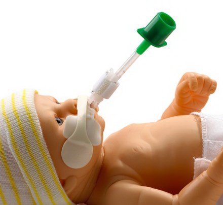 NEO-fit - Neonatal Endotracheal Tube Grip Set - 42-2540