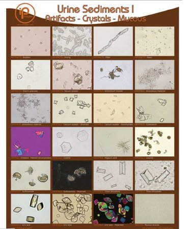 Market Lab - Poster and Binder Cards Urine Sediments 19 X 24 Inch - 1888