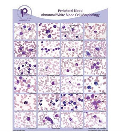 Market Lab Inc Anatomical Chart Blood Abnormal WBC Morphology Laminated - 7813