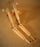 Baugh Medical Upper Extremity Prosthetic - UEP