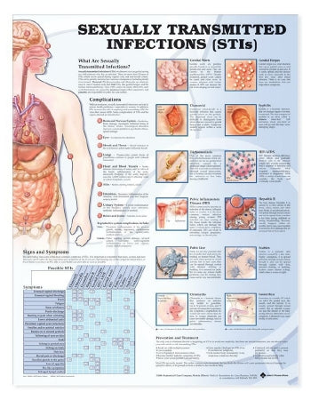 Anatomical Chart Company Anatomical Chart Sexually Transmitted Infections (STIS) 20 X 26 Inch Heavy Paper Grommets Laminated - 9781587798498