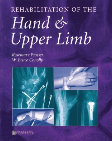 Patterson Medical Supply Reference Book Rehabilitation of the Hand and Upper Limb Rosemary Prosser, BApSc (Physio), MSc, CHT and W. Bruce Conolly, AM, FRACS, FRCS, FACS - 554575