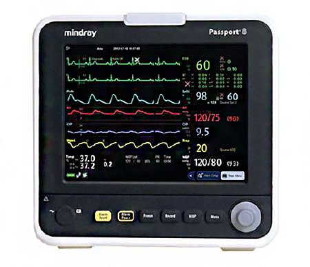 Mindray USA PassPort Vital Signs Monitor Passport ECG, SpO2, NiBP, Respiration, Temperature - 6104F-PA00001