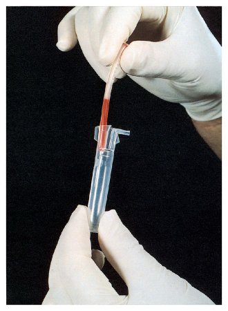 Alpha Scientific SEG·SAFE - Segment Processor For Centrifuge - 15059350