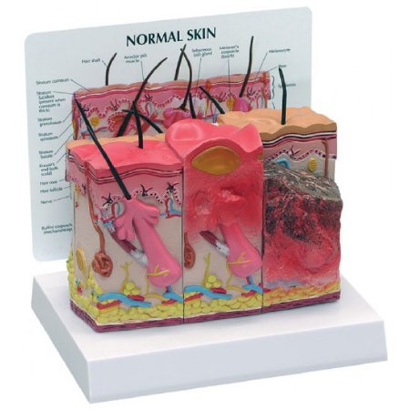 Nasco - Skin Burn Normal Model - SB46482