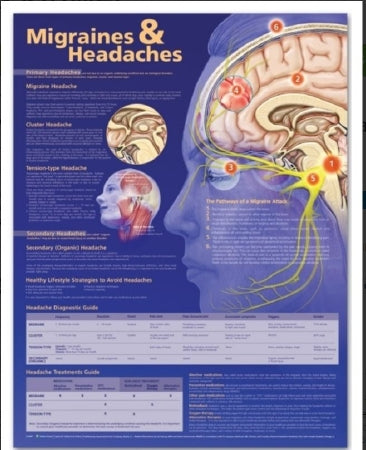 Anatomical Chart Company Anatomical Chart Migraines & Headaches 20 X 26 Inch Heavy Paper Grommets Laminated - 9780781776608