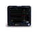 Patient Monitor