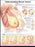 Anatomical Chart Company Anatomical Chart Breast Cancer 20 X 26 Inch Heavy Paper Grommets Laminated - 9781451185652