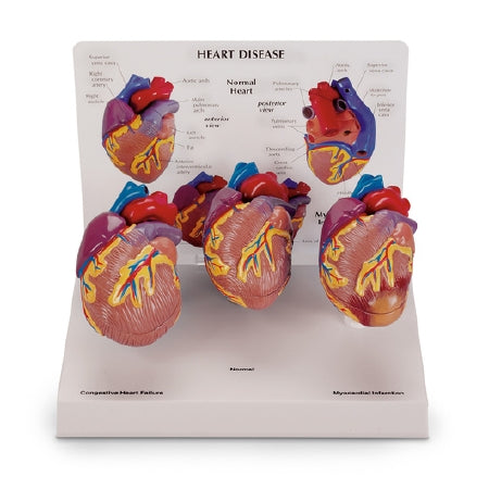 Nasco Nasco Heart Models - SB44893
