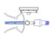 ChemoClave - Vial Spike - CH-80