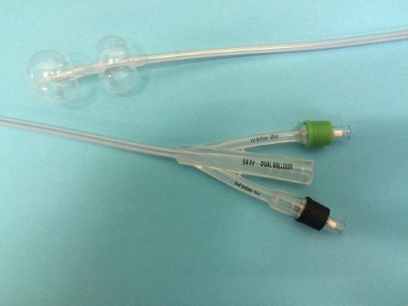 Poiesis Duette Foley Catheter 2-Way Subsumed Tip 10 cc Proximal Balloon, 5 cc Distal Balloon 16 Fr. Silicone - D-10016