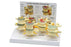 Dynatronics 4 Stage Degenerative Vertebrae Set Life Size - DLM1