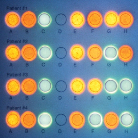 Edvotek DNA/RNA Microarray - Student Lab Activity - S05648