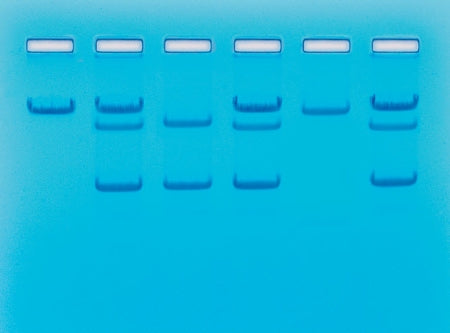 Edvotek Sickle Cell Gene Detection (DNA-based) - Student Lab Activity - S96346