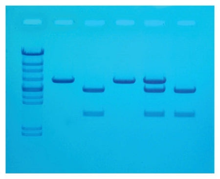 Fisher Scientific Edvotek Cholesterol Diagnostics Educational Kit 8 gels, Refrigerated - S94608
