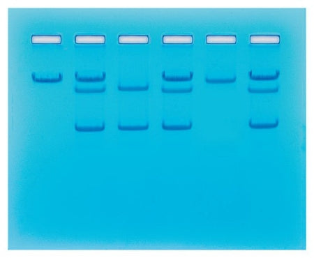 Edvotek - Sickle Cell Gene Detection (Dna-Based) Classroom Educational Kit 8 gels, 45 minutes Time Range, Refrigerated - Fisher Scientific - S94670