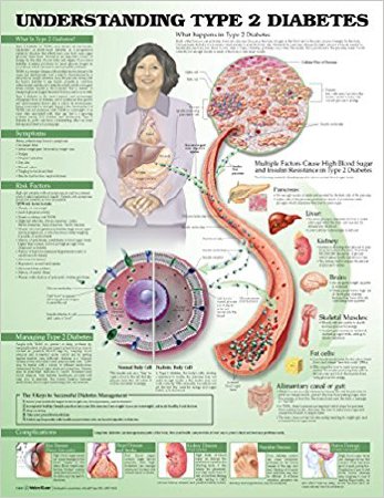 Anatomical Chart Company - Anatomical Chart Type 2 Diabetes 20 X 26 Inch Heavy Paper Grommets Laminated - 9781469894980