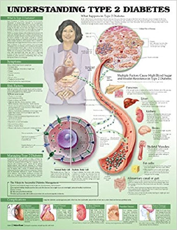 Anatomical Chart Company Anatomical Chart Type 2 Diabetes 20 X 26 Inch Heavy Paper Grommets Laminated - 9781469894980