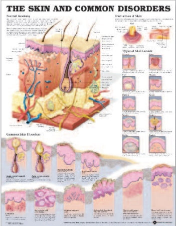 Anatomical Chart Company Anatomical Chart Skin Disorder 20 X 26 Inch Heavy Paper Grommets Laminated - 9781587796135