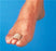 Alimed Silopad Digit Pad Large / X-Large Slip-On Toe or Finger - 60348