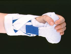 Alimed AliMed Grip Splint II Hand Grip Standard - 510328