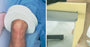 Alimed Leg Holder - 931961